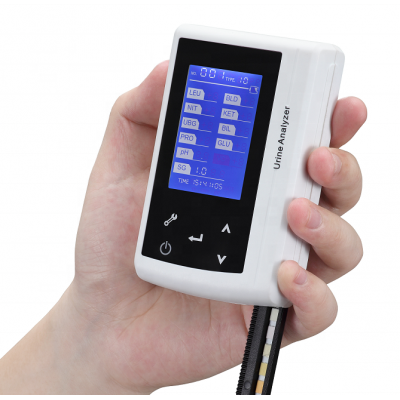 140 tests per hour urine analysis machine / mini urine analyzer device factory price U5